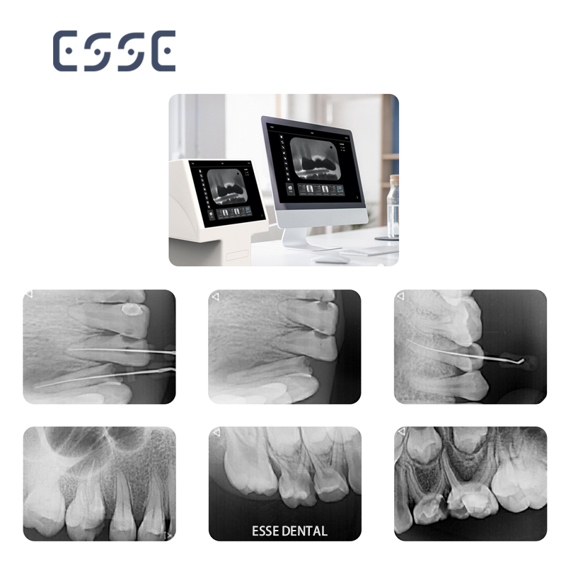 Dental Digital X-ray Intraoral Imaging Phosphor Plate Scanning PSP Scanner