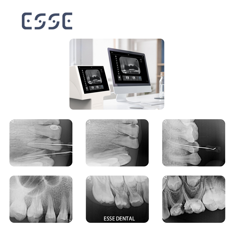 Dental X-ray Imaging Phosphor Plate Scanning PSP Scanner
