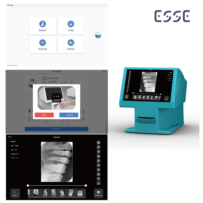 Dental X-ray Imaging Phosphor Plate Scanning PSP Scanner