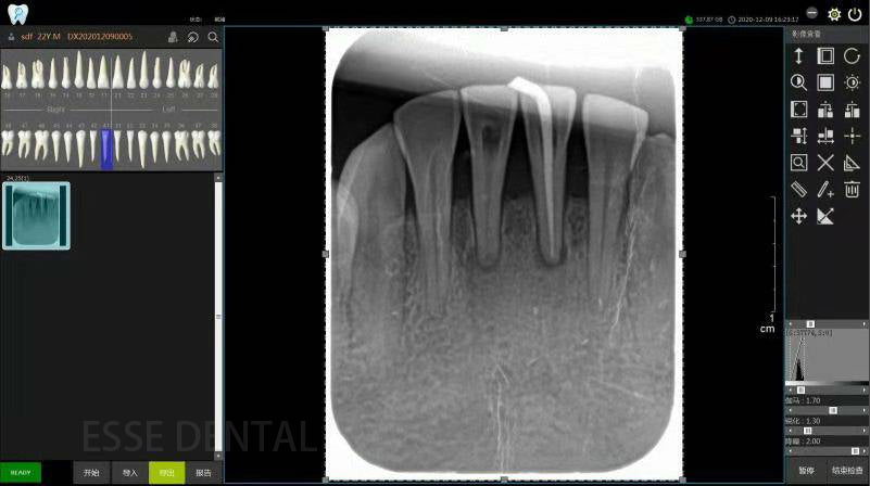 Digital Sensor X-Ray Dental Sensor Rvg For Dentists And Veterinarians Dynimage DX01 DX02 DX03